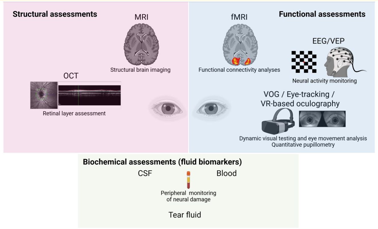 Current main methods to assess brain strcuture