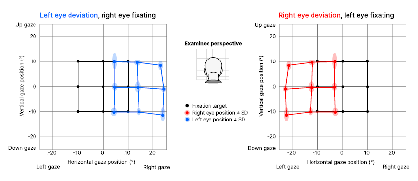 ocularalignment